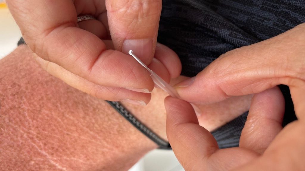 Pain relief from tiny Acupuncture needles.