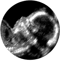 embryo